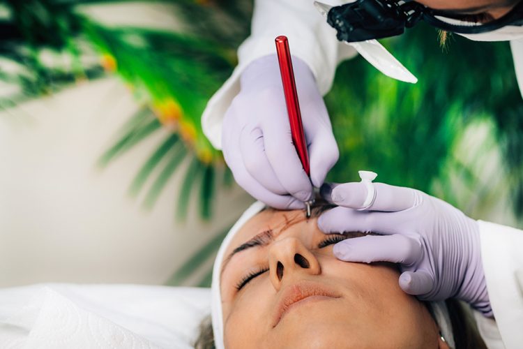 Microblading